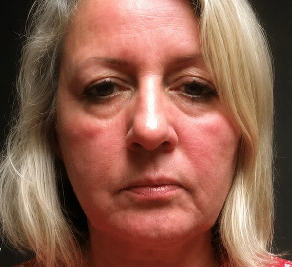AVANT — Isabelle D.